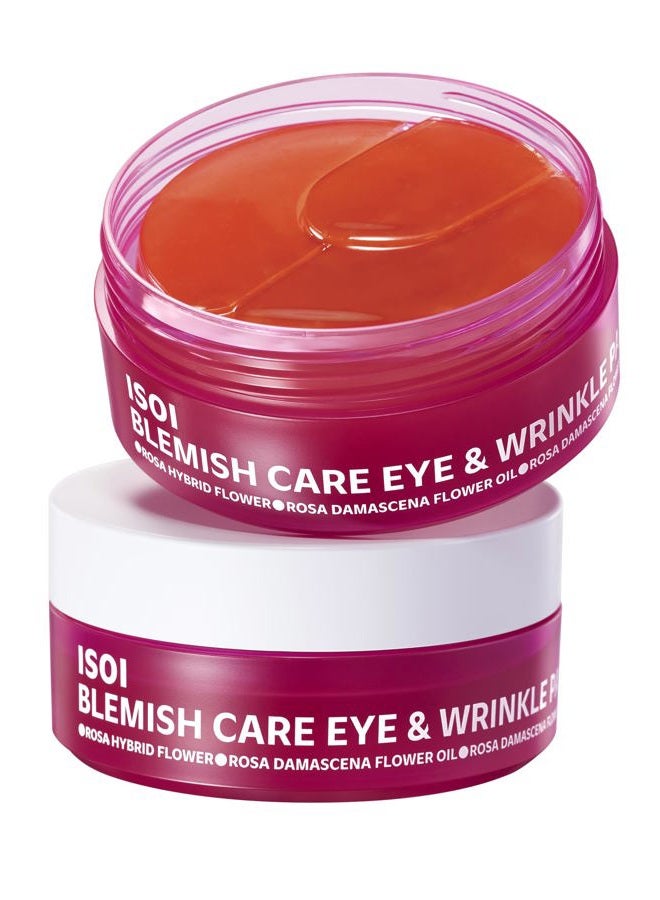 ISOI Blemish Care Under Eye Patch for Dark Circles, Puffiness and Wrinkles, Hydrating Gel Eye Masks with Hyaluronic Acid & Bulgarian Rose Oil, Korean Skin Care (90 pcs, 3.17 oz) - Image 1