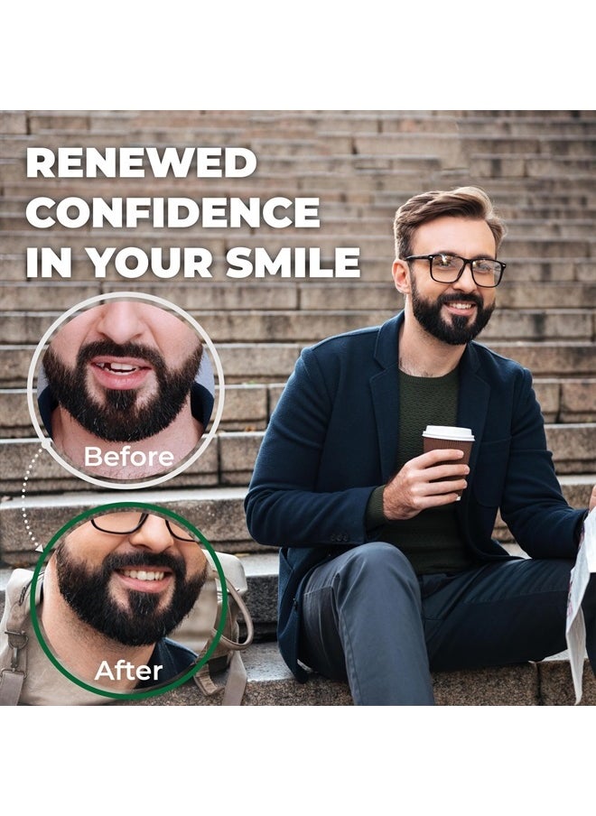 Amazing Temporary Tooth - (Natural Shade) Amazing Temporary Tooth Replacement Kit, Temp Missing Teeth Repair, Available in Natural or Bright Shade - Image 1