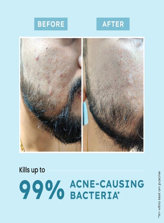 Hyphen Clarifying Acne Face Wash for Women and Men | Cleanser For Acne Prone Skin with Salicylic Acid 2%, Zinc PCA, Witch Hazel 10% | Oil Control Pore Cleasning | Antibacterial & Non-Drying - 100ml - Image 3