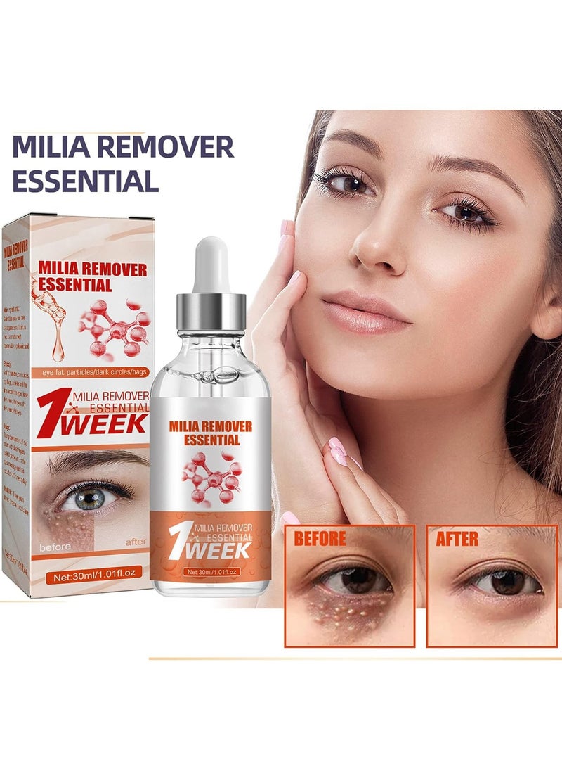 SOUTH MOON - Quick Milia Remover, Milia Remover Essential, Fade Fine Lines, Eye Essence with Fine Line Fade, Milia Spot Treatment for Eye, Lift and Tighten the Eye Essence - Image 1