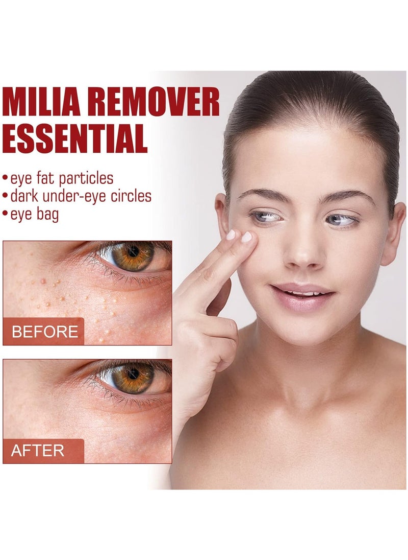 SOUTH MOON - Quick Milia Remover, Milia Remover Essential, Fade Fine Lines, Eye Essence with Fine Line Fade, Milia Spot Treatment for Eye, Lift and Tighten the Eye Essence - Image 1