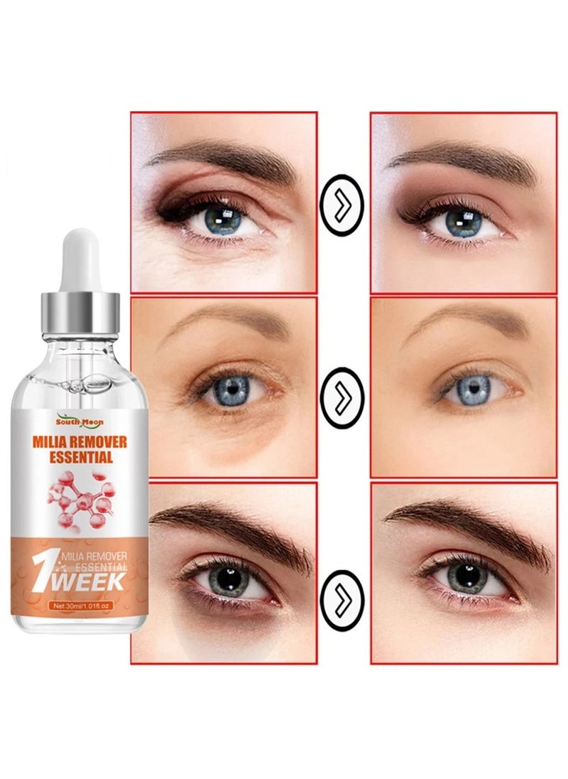 SOUTH MOON - Quick Milia Remover, Milia Remover Essential, Fade Fine Lines, Eye Essence with Fine Line Fade, Milia Spot Treatment for Eye, Lift and Tighten the Eye Essence - Image 1
