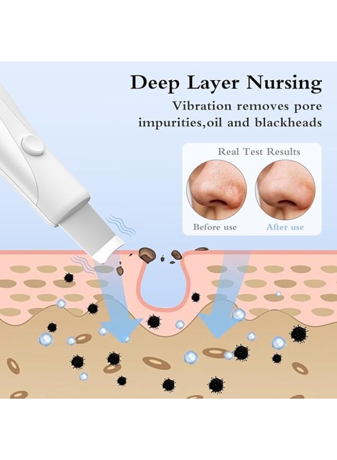 جهاز تنظيف وتقشير البشرة (سكرابر) بالموجات فوق الصوتية - لإزالة الرؤوس السوداء وتنظيف المسام - عملي للرجال والنساء - Image 3
