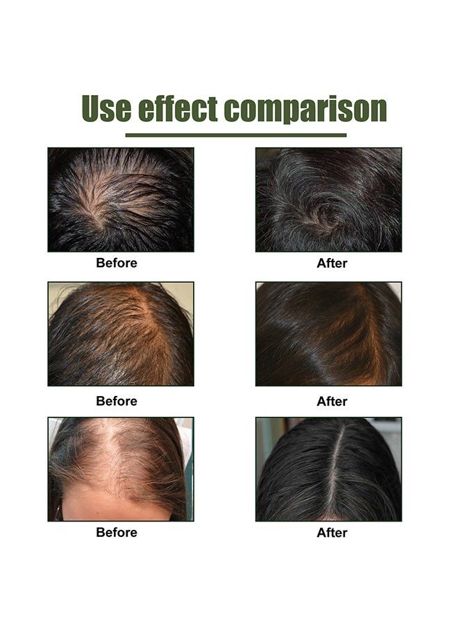EELHOE Hair Lotion，For Thicker Hair Encourage Hair Growth，Grapefruit Hair Care Spray Strengthen and Repair Hair Roots, Prevent Hair Loss and Maintain Hair Essential Oil  - Image 3