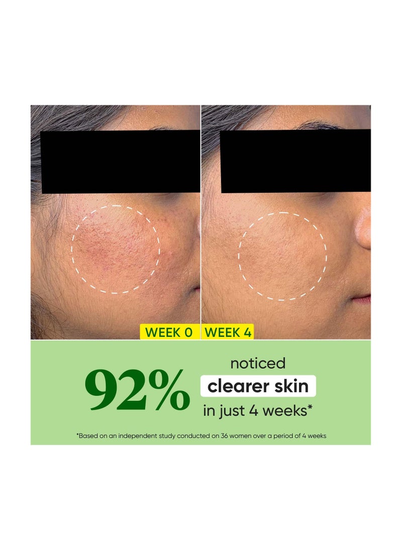 Cica + Niacinamide Oil-Free Face Moisturizer For Calm, Acne Free Hydrated Skin Fades Acne Scars & Dark Spots, Soothes Redness & Irritation | For Oily, Acne Prone & Sensitive Skin | 60Ml