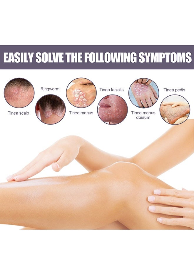 EELHOE Eczema and Psoriasis Non-Steroidal 100% Natural Relief，Atomizing Spray 30ml, Hand and Foot Moss Skin Repair, Relieve Itching, Skin care and Jiejia spray, Antibacterialnot Irritating Safety - Image 5