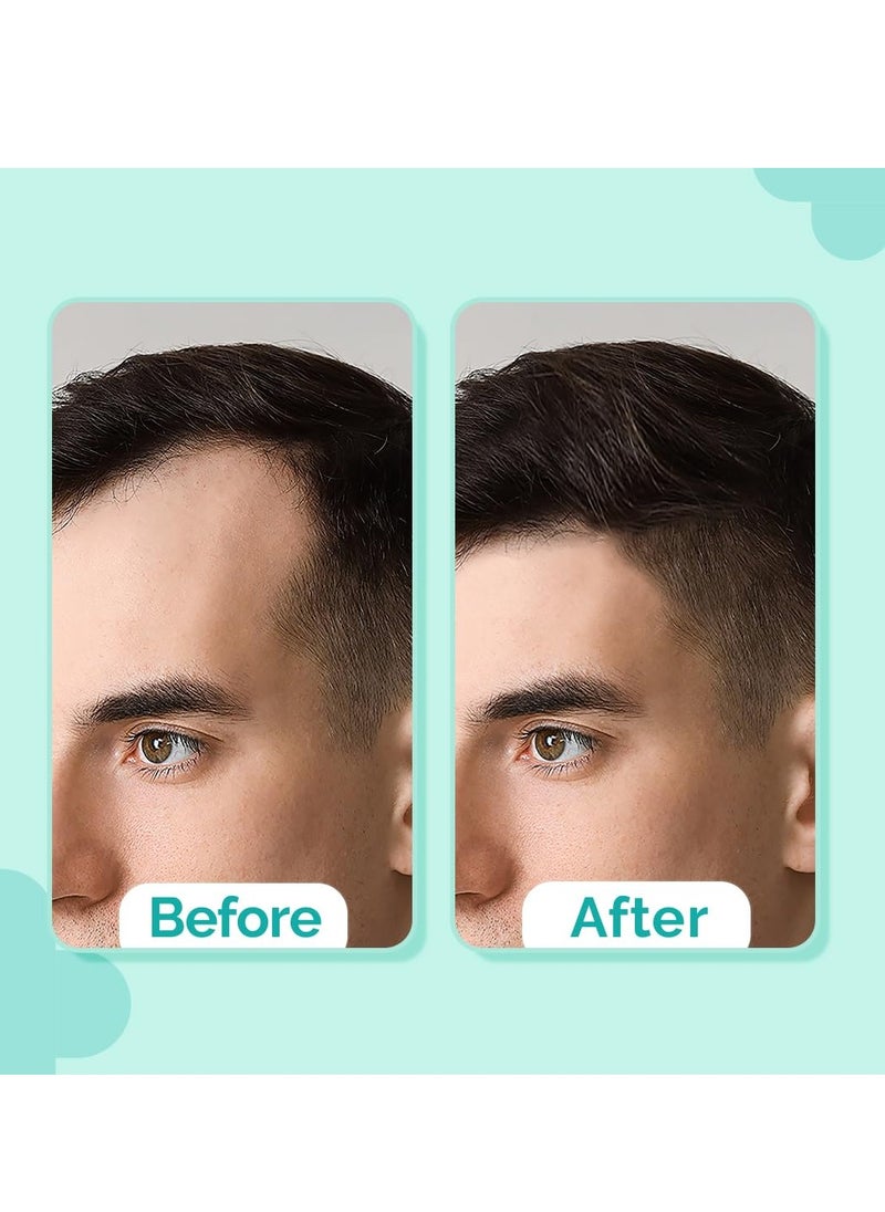 THE derma Co - Hair Growth Serum 20 Percent Actives Peptide Stem Cell 30ml With 9 Percent Foligen Analupe 4 Percent Anagain 3 Percent Copper Peptide 1 Percent Redensy For Hair Growth Reduces Hair Fall 30ML - Image 1