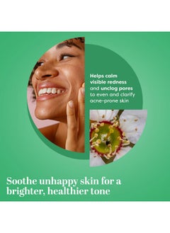 TruSkin TruSkin Tea Tree Oil for Face - Acne Serum - Unclog Pores, Soothe Breakouts - Blemish Spot Treatment for Smooth, Glowing Skin - Tea Tree Oil for Skin + Salicylic Acid, Niacinamide & Retinol - 1 fl oz  - Image 3