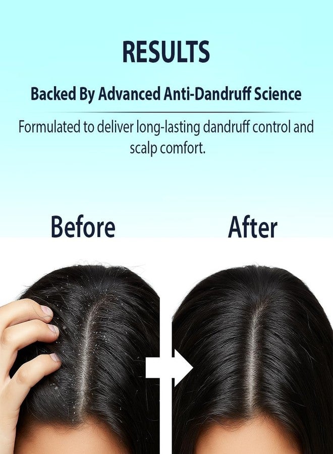 Dermistry Anti-Dandruff Hair Mask with Climbazole Piroctone ZPTO Reduces Dryness Flakes Itching Irritation Exfoliates Both Dry Oily Itchy Scalp Suits Dry Frizzy Curly All Hair Type For Men women 200ml - Image 5