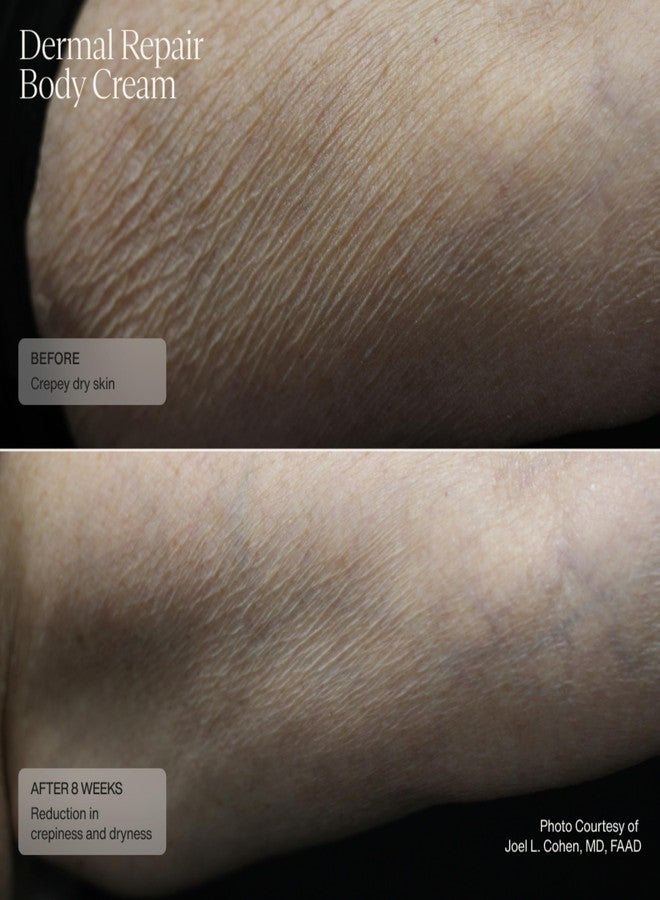 Sente Senté Dermal Repair Body Cream | Restore Skin's Barrier | Soothes Sensitive Skin | Promotes New Collagen Production for Firmer Skin | 6 Fl Oz - Image 5