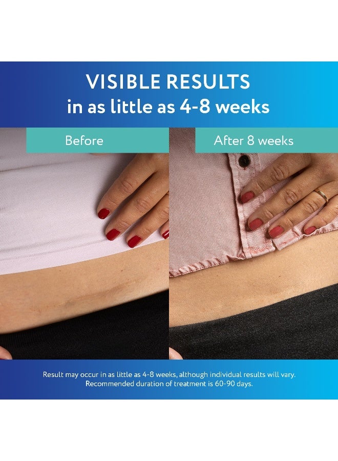 ScarAway Advanced Clear Silicone Scar Sheets Medical Grade Silicone Strips 15 x 3 Scar Treatment and Prevention for Surgical Burn Body Hypertrophic Keloid Scar Treatment 6 Clear Sheets - Image 4