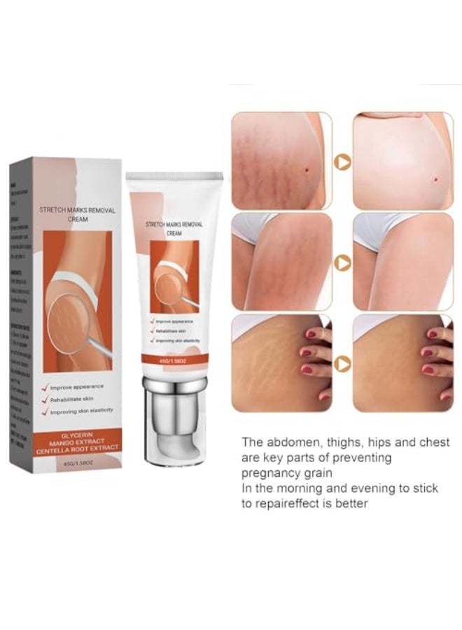 EELHOE Stretch Marks Removal Cream, Repair Cream for Pregnancy, Stretch Marks, Moisturising, Abdominal and Body Care, Anti-Stretch Marks, Firming Body Cream, 45g - Image 5