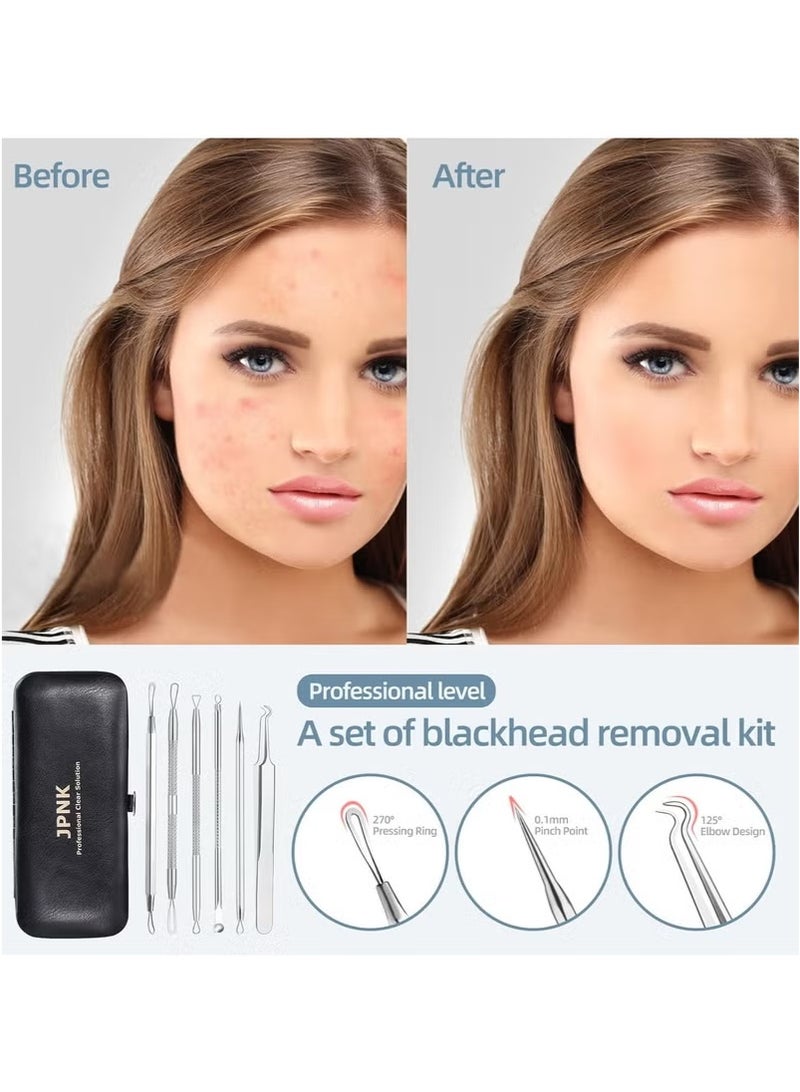 JPNK JPNK Blackhead Remover Tool Comedones Extractor Acne Removal Kit for Blemish, Whitehead Popping, 6 Pcs Zit Removing for Nose Face Tools with a Leather Bag  - Image 3