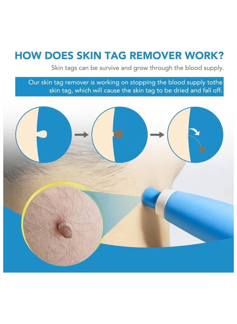 سيفودون جهاز إزالة علامة الجلد FDA-Cleared آمنة وفعالة إزالة علامة الجلد مجموعات الاستخدام المنزلي - Image 4