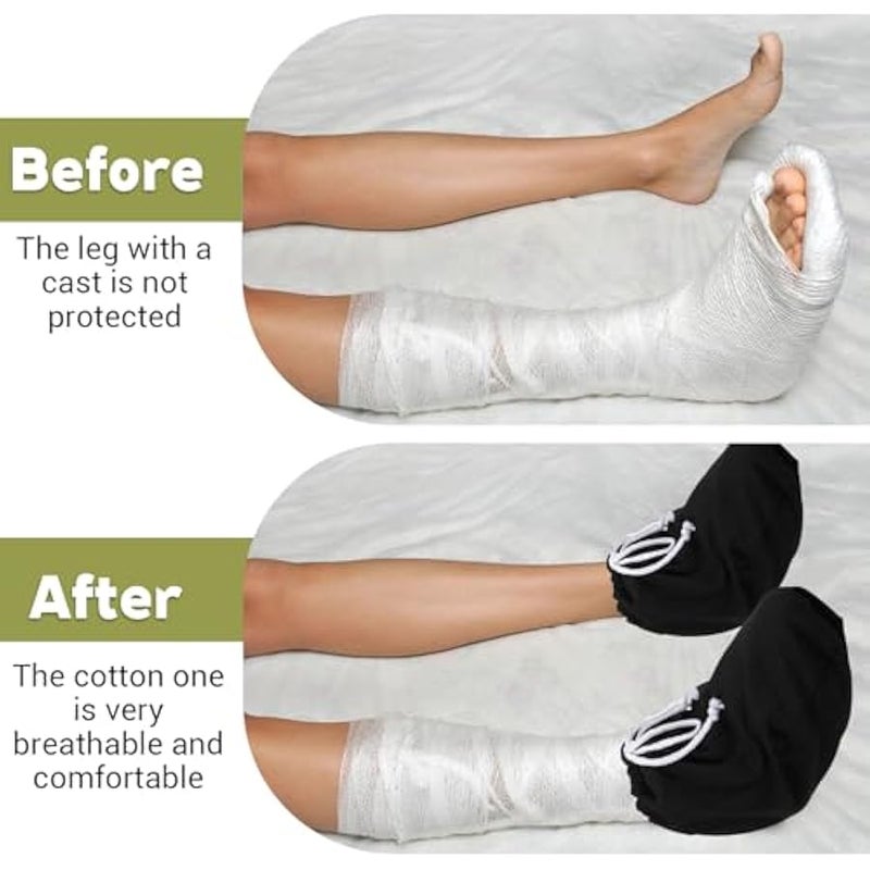 2PCS Cast Sock Cover for Foot, Adjustable Drawstring Leg Cast Sock, Toe Cover Socks Leg Casts Covers Below The Knee, Plaster Socks for Feet, Suitable for Men and Women - Image 4