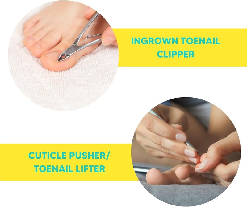 Onyx Professional Ingrown Toenail Kit - Image 5