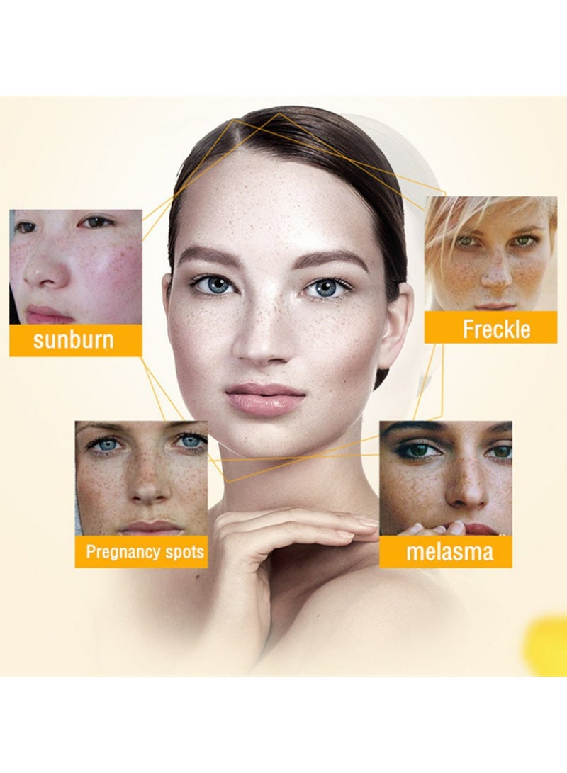iBealee Dark Spot Remover for Face Peeling Skin, Whitening Freckle Cream Pigmentation Treatment Sun Spots Age Spots Blemish Remover Lightening Cream, Mildly Remove Freckles Age, Chloasma Repairing Face Cream  - Image 4