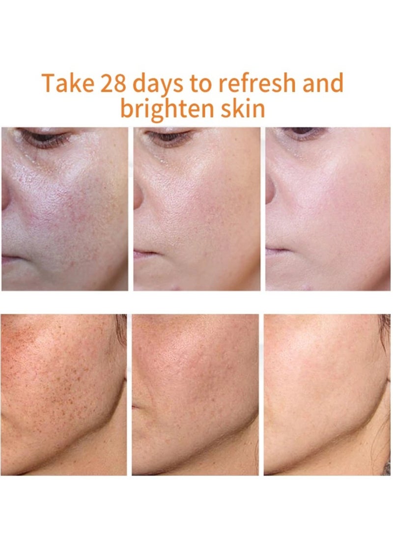 iBealee Dark Spot Remover for Face Peeling Skin, Whitening Freckle Cream Pigmentation Treatment Sun Spots Age Spots Blemish Remover Lightening Cream, Mildly Remove Freckles Age, Chloasma Repairing Face Cream  - Image 5