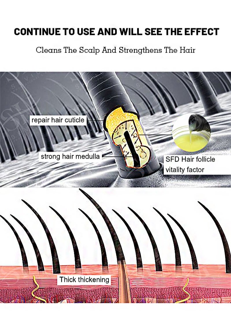 Natural Anti Hair Shampoo 200ml, Anti Hair Loss Recovery Effective Solution, Natural Hair Care Essential Shampoo for Men & Women