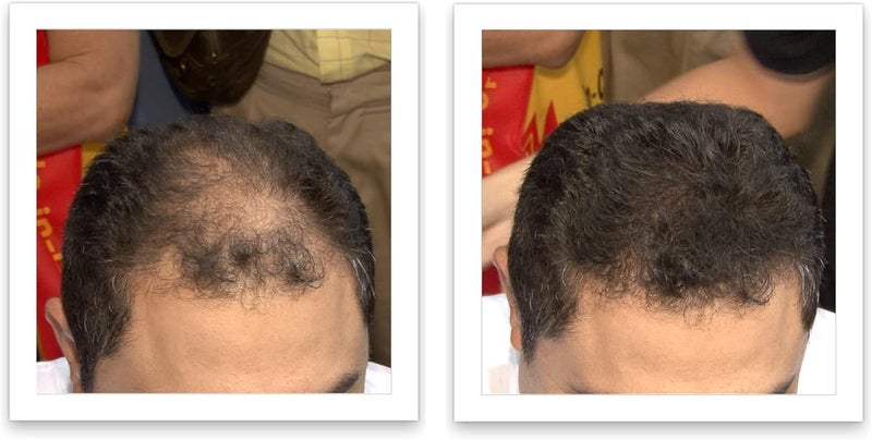 Caboki Hair Building Fiber 25g - Dark Brown - Professional Grade Hair Loss Concealer - Image 4