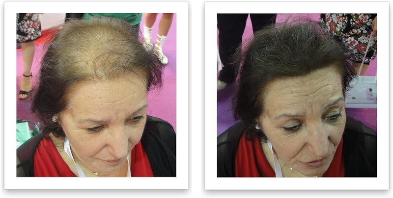 Caboki Hair Building Fiber 25g - Dark Brown - Professional Grade Hair Loss Concealer - Image 3