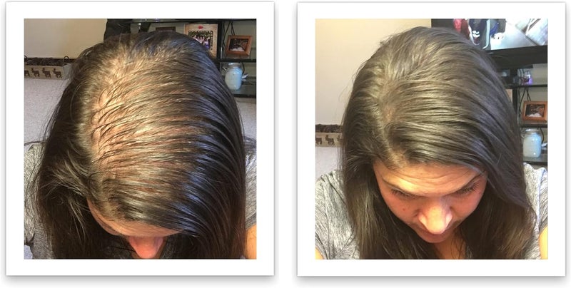 Caboki Hair Building Fiber 25g - Dark Brown - Professional Grade Hair Loss Concealer - Image 5