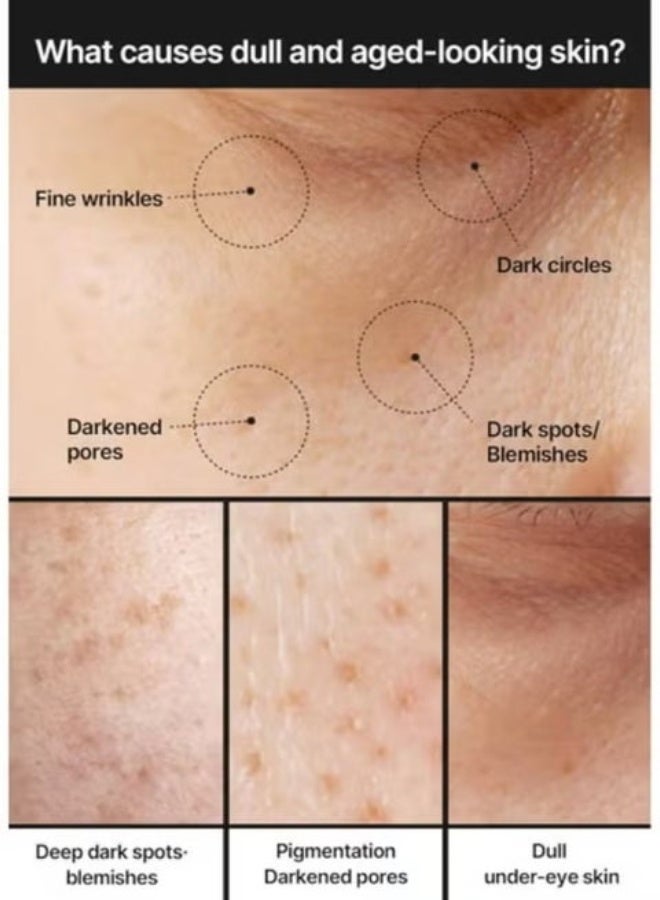 celimax Pores and dark spot brightening cream, minimal pores, moisturizing for sensitive skin, daily use cream - Image 5