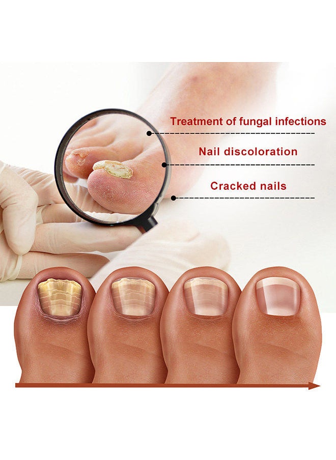West&Month West&Month 30ml Grey Nail Repair Solution Natural Anti-fungal Nail Correction Essence Restore Luster  - Image 3