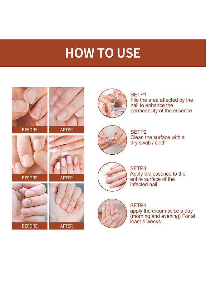 West&Month West&Month 30ml Grey Nail Repair Solution Natural Anti-fungal Nail Correction Essence Restore Luster  - Image 4