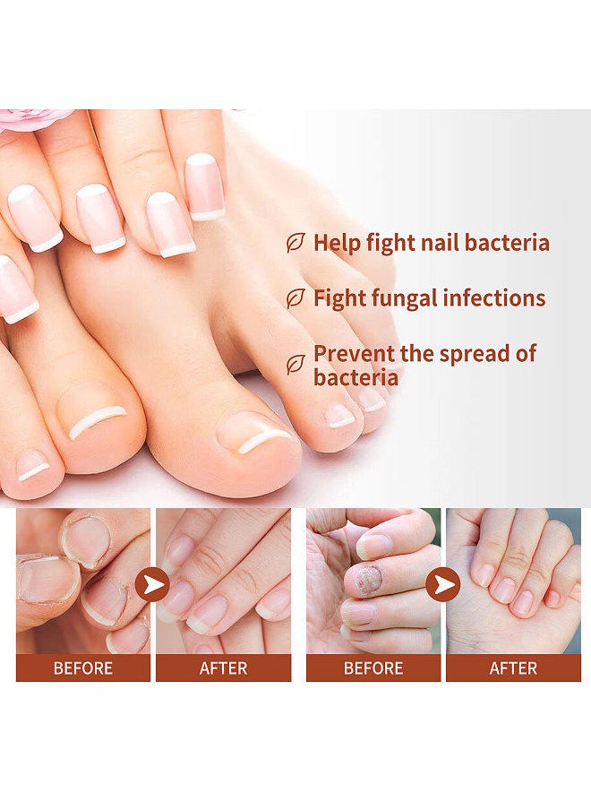 West&Month West&Month 30ml Grey Nail Repair Solution Natural Anti-fungal Nail Correction Essence Restore Luster  - Image 5