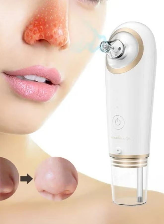 KinseiBeauty 4-In-1 Facial Pore Blackhead Remover, Vacuum Micro Bubble Blue Light Pore Cleansing Tool - Image 1