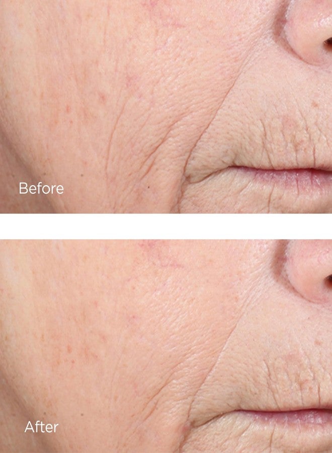 Perricone MD Vitamin C Ester CCC+ Ferulic Brightening Complex 20%, 2 fl. oz. - Image 4