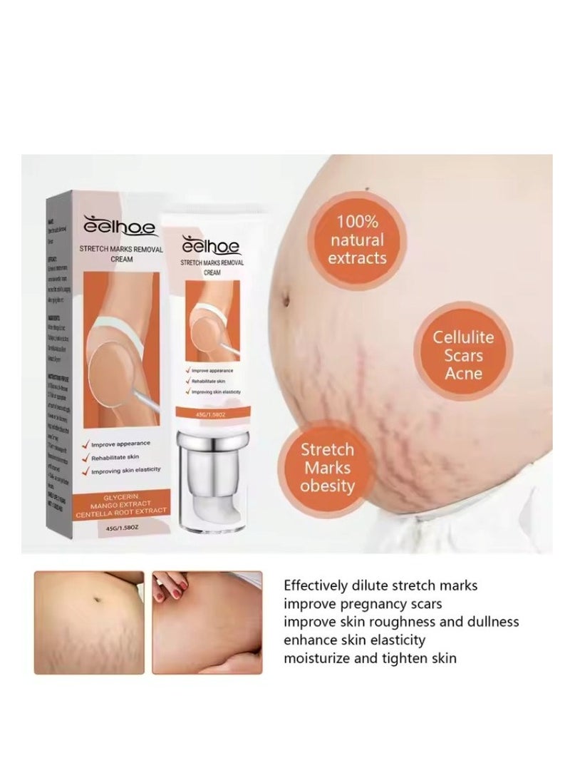 EELHOE EELHOE Pregnancy Scar Repair Cream Stretch Mark Removal Removal Acne Scar Stretch Marks Cream Fat Striae Gravidarum Treatment Body Creams Treatment Maternity Repair Anti-Aging Anti-Winkles Firming Body Creams  - Image 2