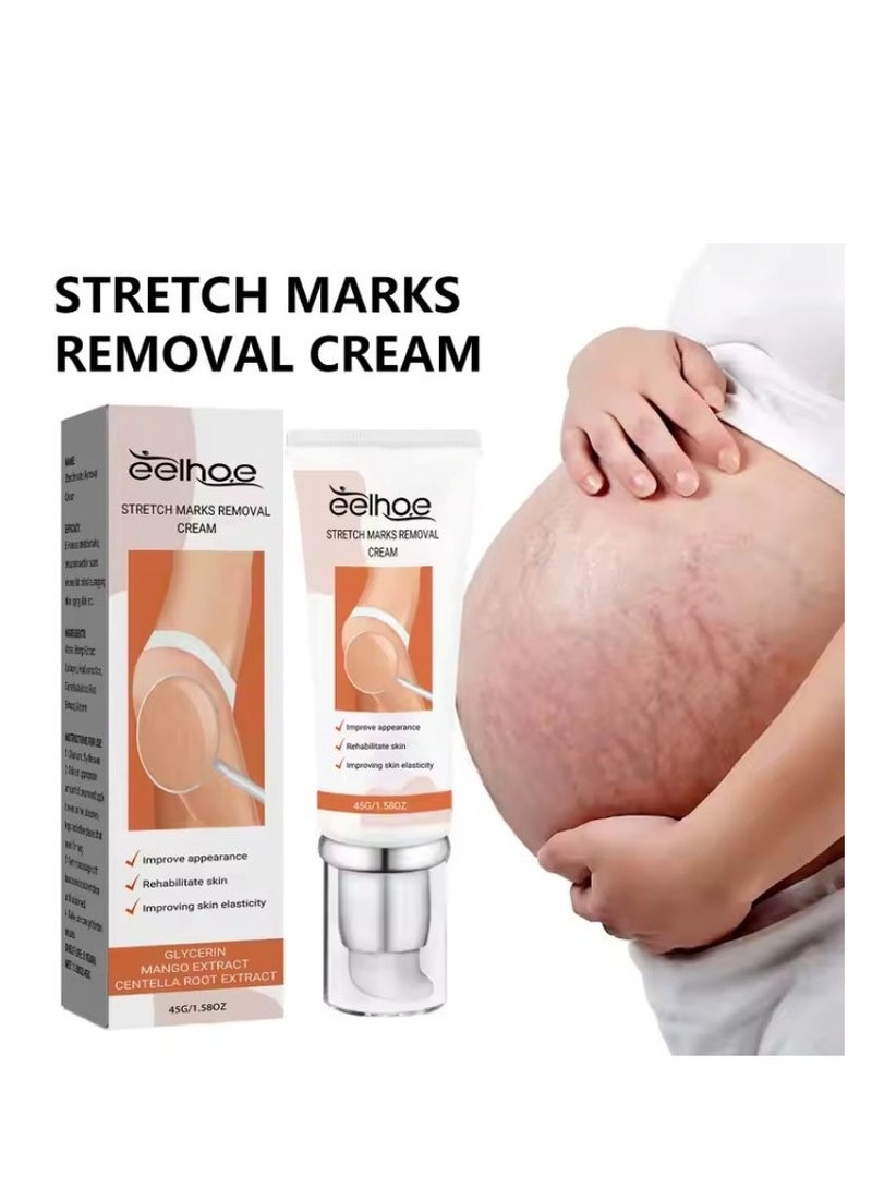 EELHOE EELHOE Pregnancy Scar Repair Cream Stretch Mark Removal Removal Acne Scar Stretch Marks Cream Fat Striae Gravidarum Treatment Body Creams Treatment Maternity Repair Anti-Aging Anti-Winkles Firming Body Creams  - Image 3
