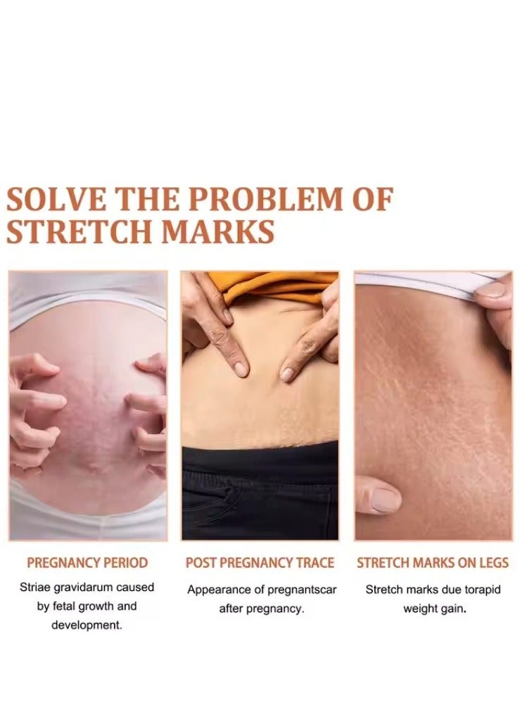 EELHOE EELHOE Pregnancy Scar Repair Cream Stretch Mark Removal Removal Acne Scar Stretch Marks Cream Fat Striae Gravidarum Treatment Body Creams Treatment Maternity Repair Anti-Aging Anti-Winkles Firming Body Creams  - Image 4