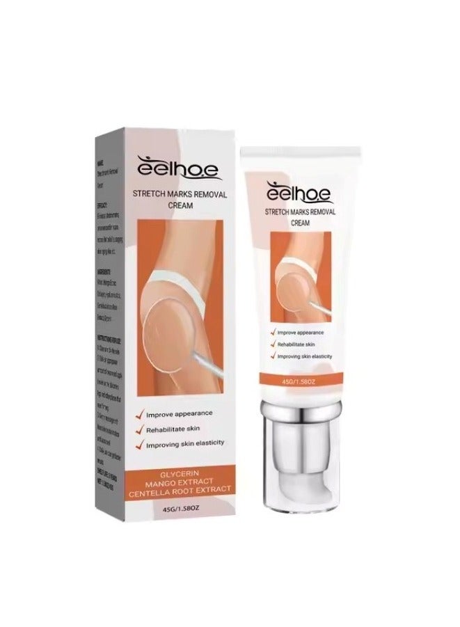 EELHOE EELHOE Pregnancy Scar Repair Cream Stretch Mark Removal Removal Acne Scar Stretch Marks Cream Fat Striae Gravidarum Treatment Body Creams Treatment Maternity Repair Anti-Aging Anti-Winkles Firming Body Creams  - Image 1