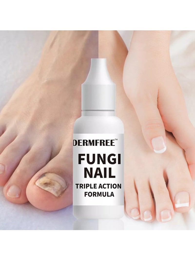 DERMFREE - Fungi Nail Triple Action Formula Treatment Liquid Toenail and Fingernails Fungus Removal Serum Stop Itching Burning and Athletes Foot Treatment Serum Restore Healthy Nails Fungal Nail Liquid 15ml - Image 1