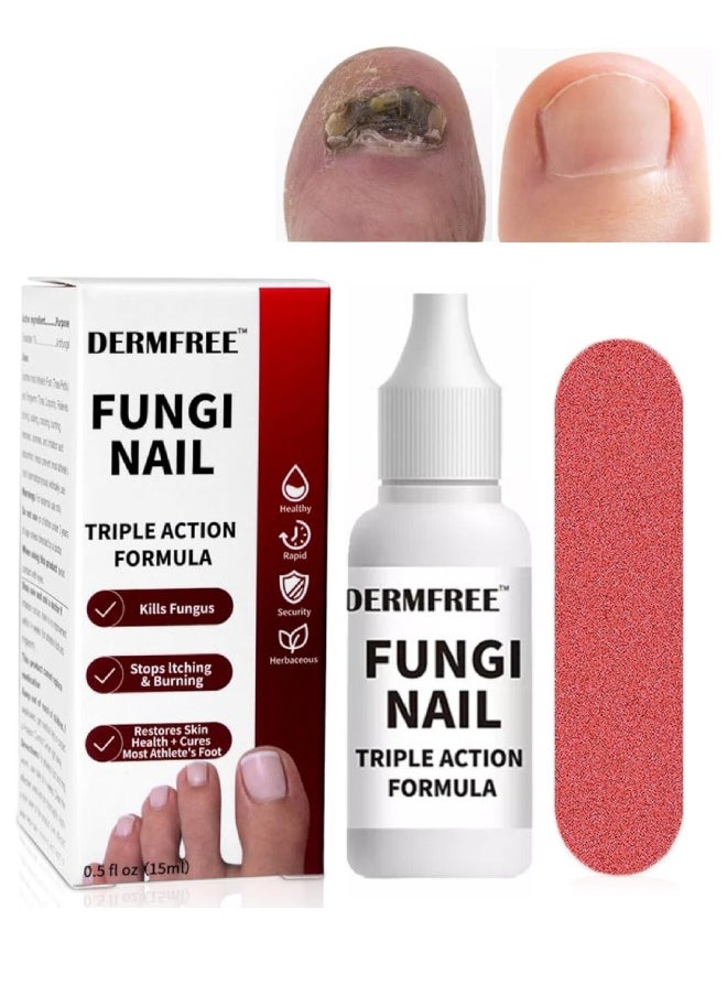 DERMFREE - Fungi Nail Triple Action Formula Treatment Liquid Toenail and Fingernails Fungus Removal Serum Stop Itching Burning and Athletes Foot Treatment Serum Restore Healthy Nails Fungal Nail Liquid 15ml - Image 1