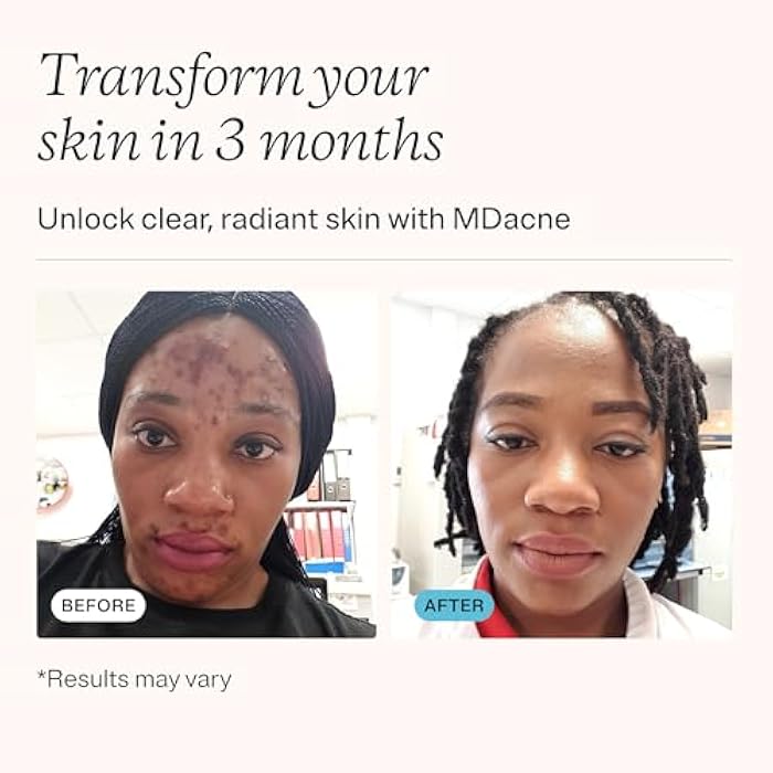 MDacne مجموعة MDacne للعناية بالبشرة من 3 خطوات - كريم الريتينول 0.25%، منظف حمض الساليسيليك، مرطب النياسيناميد - منتجات نباتية لحب الشباب الهرموني، والبقع، والتجاعيد. مجموعة كاملة للعناية بالبشرة لمدة 30 يومًا. - Image 3