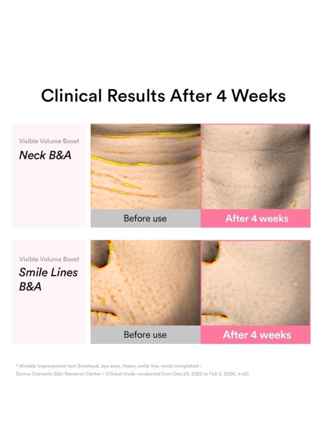 ابيب كريم Abib PDRN Volume Fill-It Booster Cream 2.5 – كريم معزز لامتلاء البشرة ومكافحة علامات التقدم في العمر، يحتوي على PDRN بتركيز 15,000 جزء في المليون (ppm) بالإضافة إلى الببتيدات والريتينال.  يساعد على تحسين مظهر الامتلاء والمرونة وشد البشرة، مع استهداف مناطق الجبهة، وخطوط الابتسامة، وتجاعيد الرقبة. صُمم لدعم البشرة في مواجهة علامات التقدم في العمر وتحسين مظهرها بشكل أكثر تماسكاً وحيوية.  الحجم: 30 مل. - Image 4