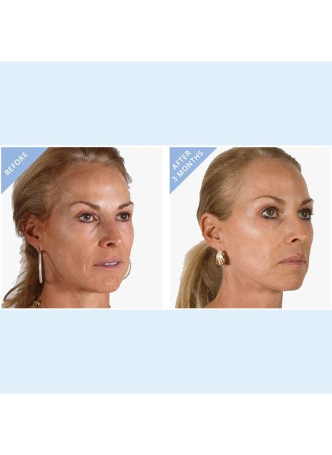 stemulation HI Impact Serum - The Ultimate Brightening Serum with Hyaluronic Acid, Vitamin C and Epidermal Growth Factors  - Image 5