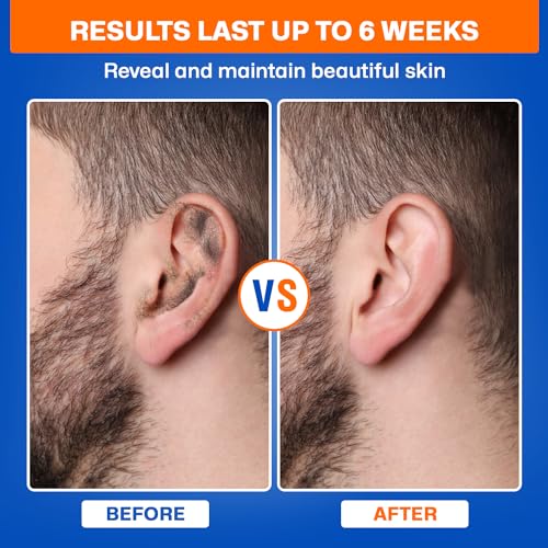 Wokaar 2-in-1 Ear & Nose Waxing Kit for Men & Women | 100g Hair Removal Wax + 99pc | 20 Applicators, 10 Nasal Sticks, 15 Wipes & 20 Earplugs | No Microwave Needed | Nose Wax Kit, Ear Hair Remover - Image 4