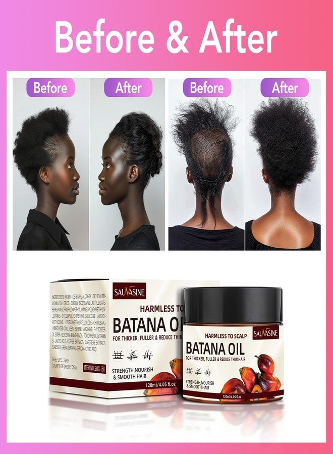 Lanthome Batana Oil for Hair Growth, Natural Dr. Sebi Hair Oil - Prevents Hair Loss, Eliminates Split Ends, Repairs Damaged Hair, Nourishes, for Men & Women- 120mL (4.05 Fl Oz) - Image 4
