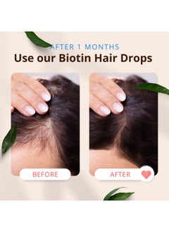 MORFOSE Biotin Hair Drop Nourishing Hair Care Solution For Promoting Growth Strengthening And Improving Texture Suitable For All Hair Types 3.38 Fl Oz  - Image 5