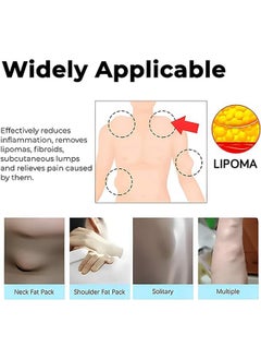 SOUTH MOON Lipoma Removal Cream 20g, Lipoma Removal Cream Ointment, Lipoma Elimination Cream, Get Rid of Your Fatty Lipoma Lumps  - Image 5