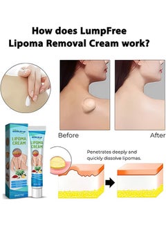 SOUTH MOON Lipoma Removal Cream 20g, Lipoma Removal Cream Ointment, Lipoma Elimination Cream, Get Rid of Your Fatty Lipoma Lumps  - Image 3