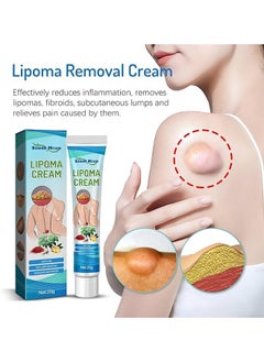 SOUTH MOON Lipoma Removal Cream 20g, Lipoma Removal Cream Ointment, Lipoma Elimination Cream, Get Rid of Your Fatty Lipoma Lumps  - Image 2