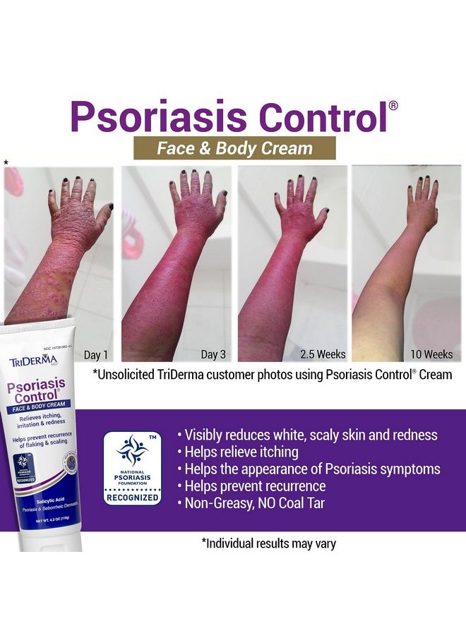 TriDerma - Riderma Psoriasis Control Face And Body Cream 4.2 Ounces - Image 1