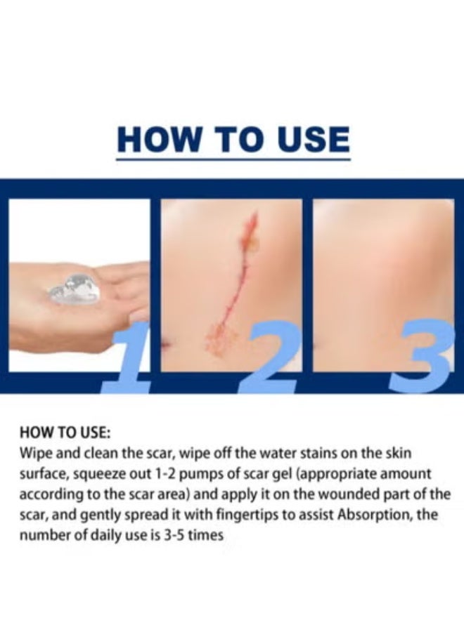 Jaysuing Silicone Scar Gel 30g Scar Cream,Scar Removal,Scar Treatment, Scar Removal Cream for C-Section, Stretch Marks, Acne, Surgery, Effective for Both Old and New Scars - Image 5