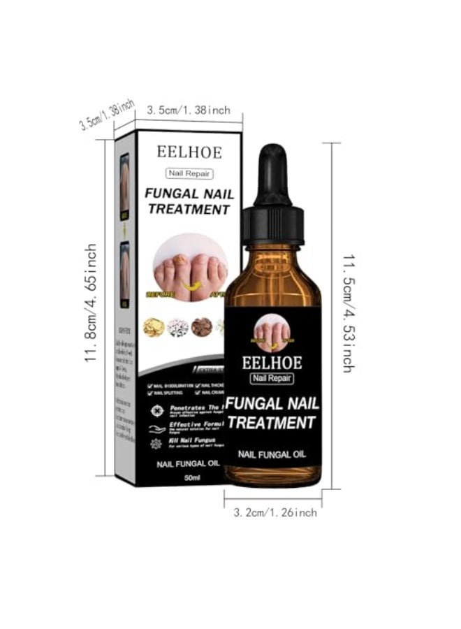 EELHOE Nail Repair Fungal Nail Treatmnt ,Toenail Fungus Treatment Extra Strength – Nail Fungal Oil with Glycerin & Panthenol, 4 Pure Natural Plant Extracts, Fung Damaged Nails, Discoloration Nails, Nail Psoriasis, Nails Aging, 50ml - Image 2